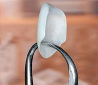 Photo of dental forceps holding a single porcelain veneers, from the office of accredited cosmetic dentist Dr. Szarek of Lowell, MA.