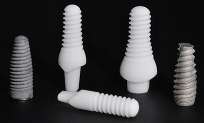 Photo of five dental implant screws. On both the left and right side is a single titanium implant, and three zirconia implants are between them.