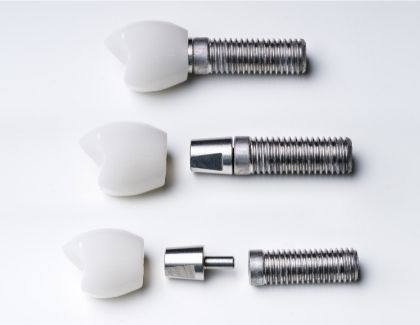 Picture of dental iimplant parts separate and put together
