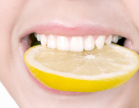 Closeup of a woman's mouth and teeth holding a lemon slice, portraying lemons and teeth whitening