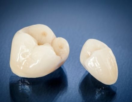 New dental crowns